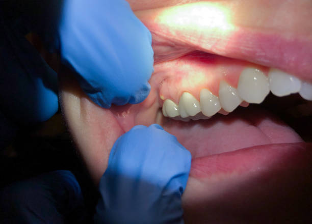 Best Cracked Tooth Emergency Dentist  in Erma, NJ