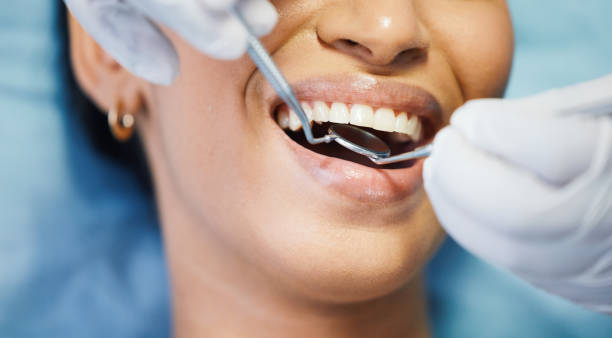 Best Chipped Tooth Repair Near Me  in Erma, NJ