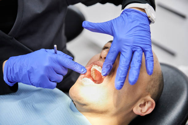 Best Dentist for Tooth Abscess  in Erma, NJ